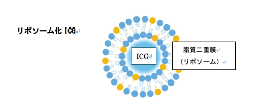 リポソーム化 ICG