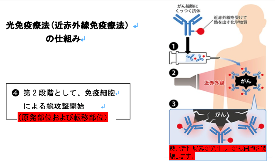 光免疫療法